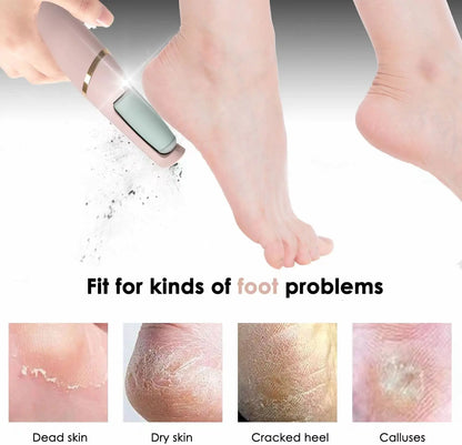 Foot Care Foot Callus Remover